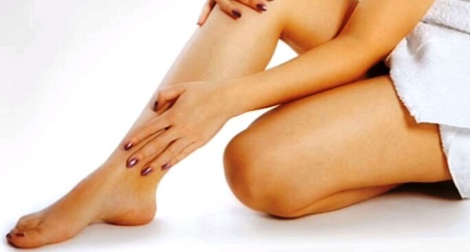 Pain caused by varicose veins in the legs