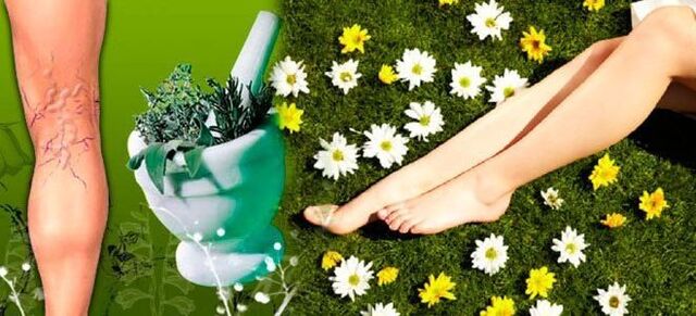 Folk remedies for varicose veins in the legs for a quick recovery