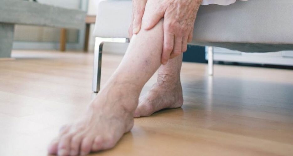 Varicose veins of lower extremities due to venous valve dysfunction